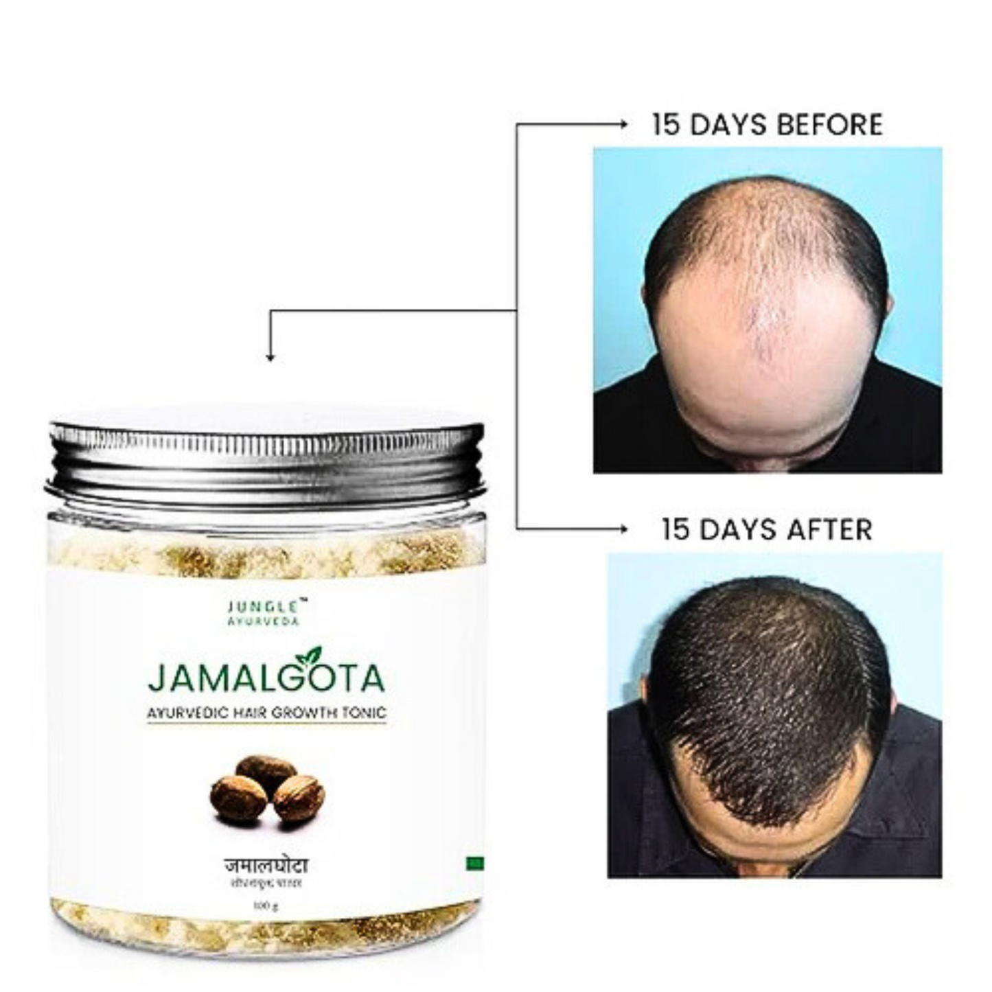 Jamalgota™ - Ayurvedic Hair Growth Powder 🌱✨ (Buy 1 Get 1 Free🔥🔥)