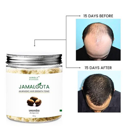 Jamalgota™ - Ayurvedic Hair Growth Powder 🌱✨ (Buy 1 Get 1 Free🔥🔥)