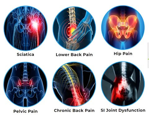 Sciatica Relief Hip Belt (COD Offer + Free Shipping🚚)